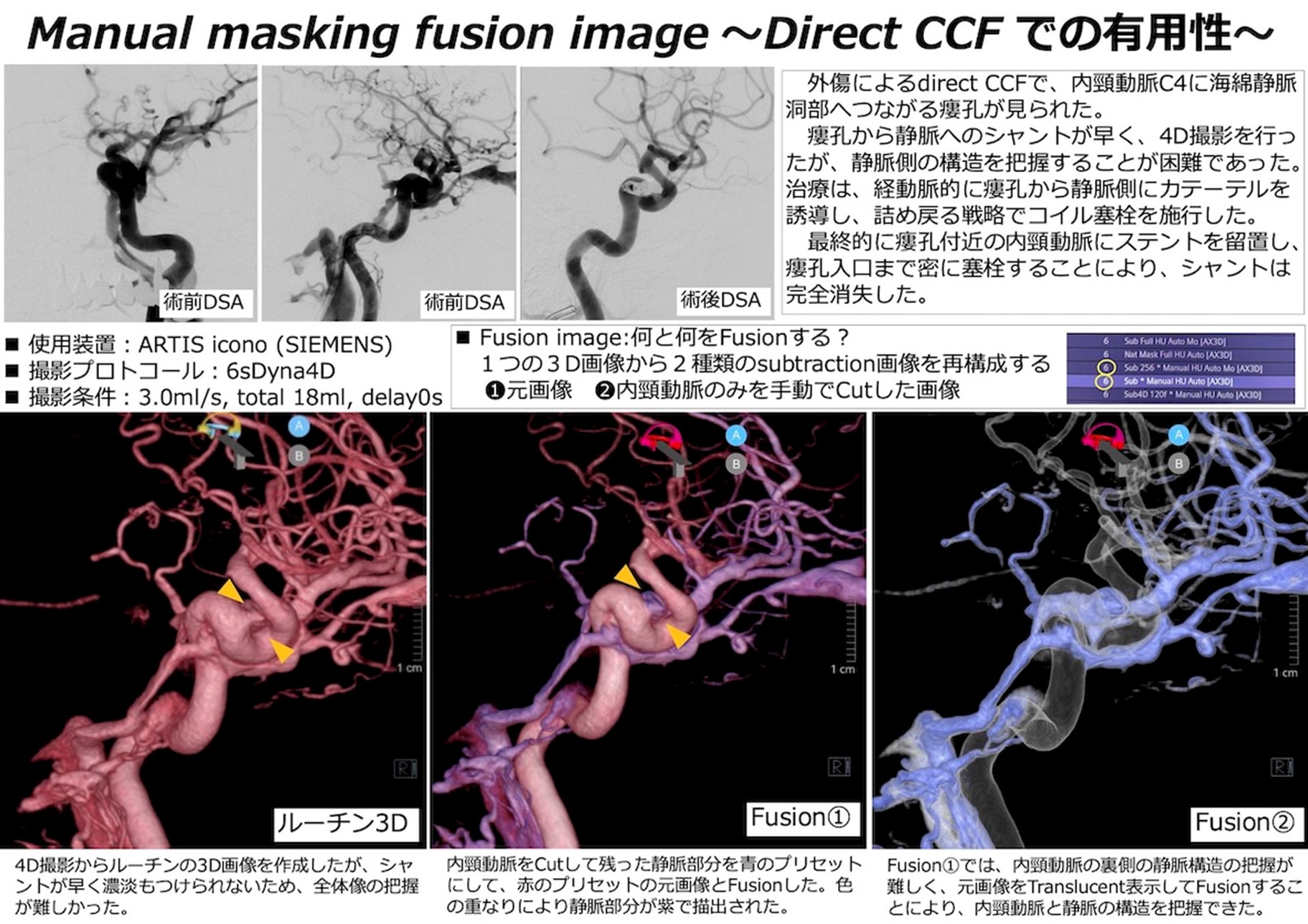 JSNET関東での一例